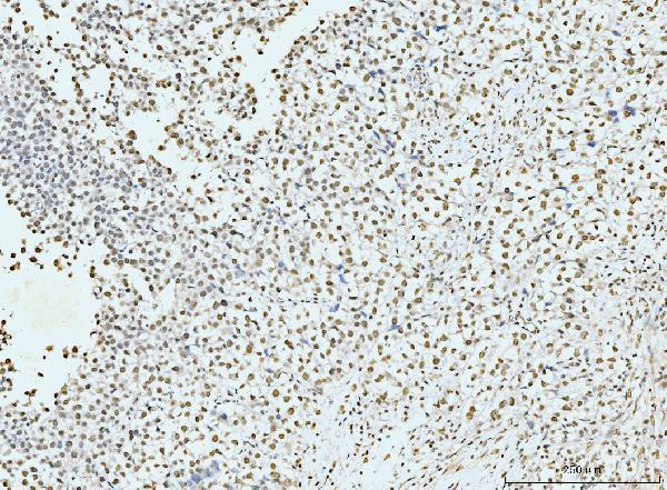  IHC analysis of p95 NBS1 using anti-p95 NBS1 antibody (M00732-1)