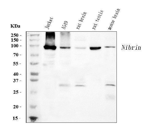  Western blot analysis of p95 NBS1 using anti-p95 NBS1 antibody (M00732-1)