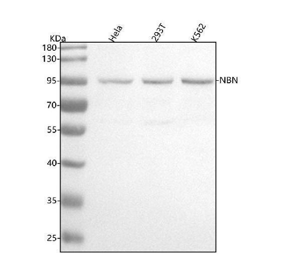  Western blot analysis of NBN using anti-NBN antibody (M00732)