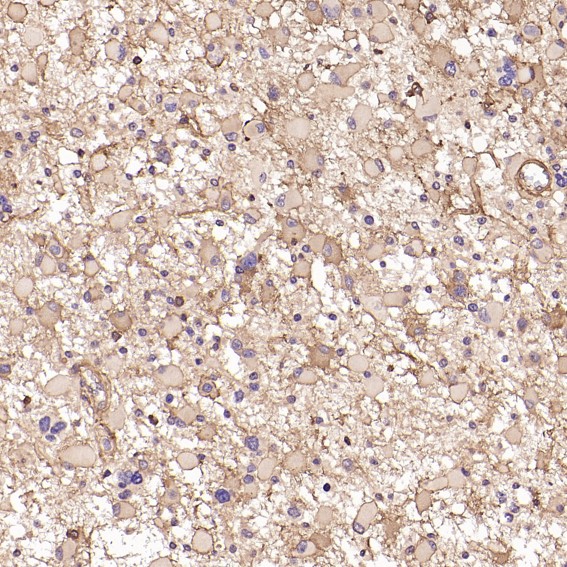 m00733 ihc8