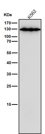 All lanes use the Antibody at 1:1K dilution for 1 hour at room temperature. All lanes use the Antibody at 1:1K dilution for 1 hour at room temperature.