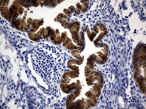Immunohistochemical staining of paraffin-embedded Human endometrium tissue within the normal limits using anti-ASL mouse monoclonal antibody
