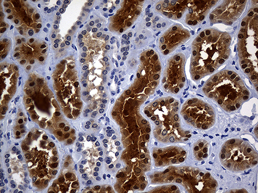 m00742 anti argininosuccinate lyase asl mouse monoclonal antibody clone id oti9g2 ihc testing 5