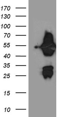 HEK293T cells were transfected with the pCMV6-ENTRY control (Left lane) or pCMV6-ENTRY ASL (Right lane) cDNA for 48 hrs and lysed