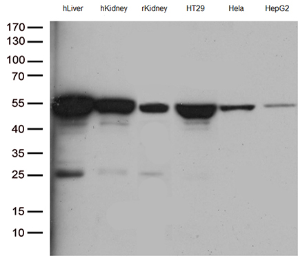 Western blot analysis of extracts (35ug) from different cell line by using anti-CTNND1 monoclonal antibody (1:500)