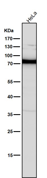 All lanes use the Antibody at 1:5K dilution for 1 hour at room temperature