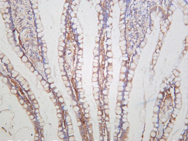 m00743 6 prkca primary antibodies ihc testing 4