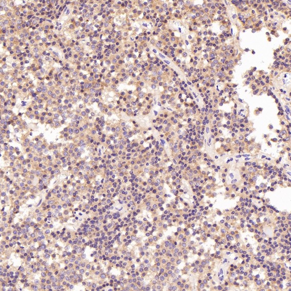 Immunohistochemical analysis of paraffin-embedded Human pituitary tumor, using the Antibody at 1:50 dilution