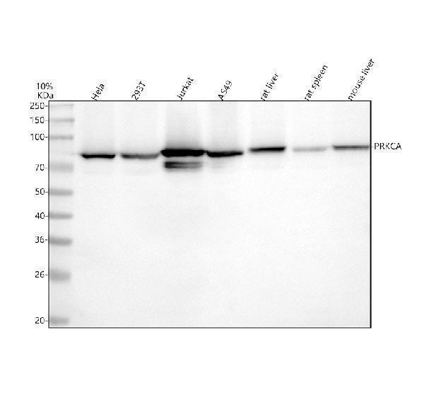  Western blot analysis of PRKCA using anti-PRKCA antibody (M00743)