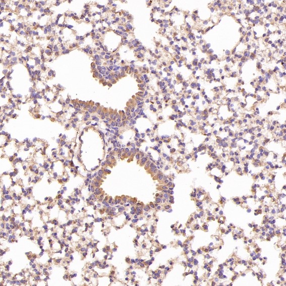 Rabbit monoclonal antibody tissue analysis