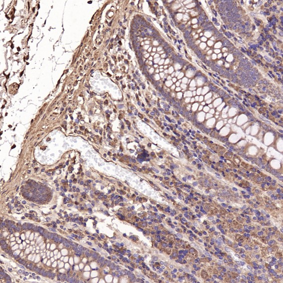 m00745 2 ihc9