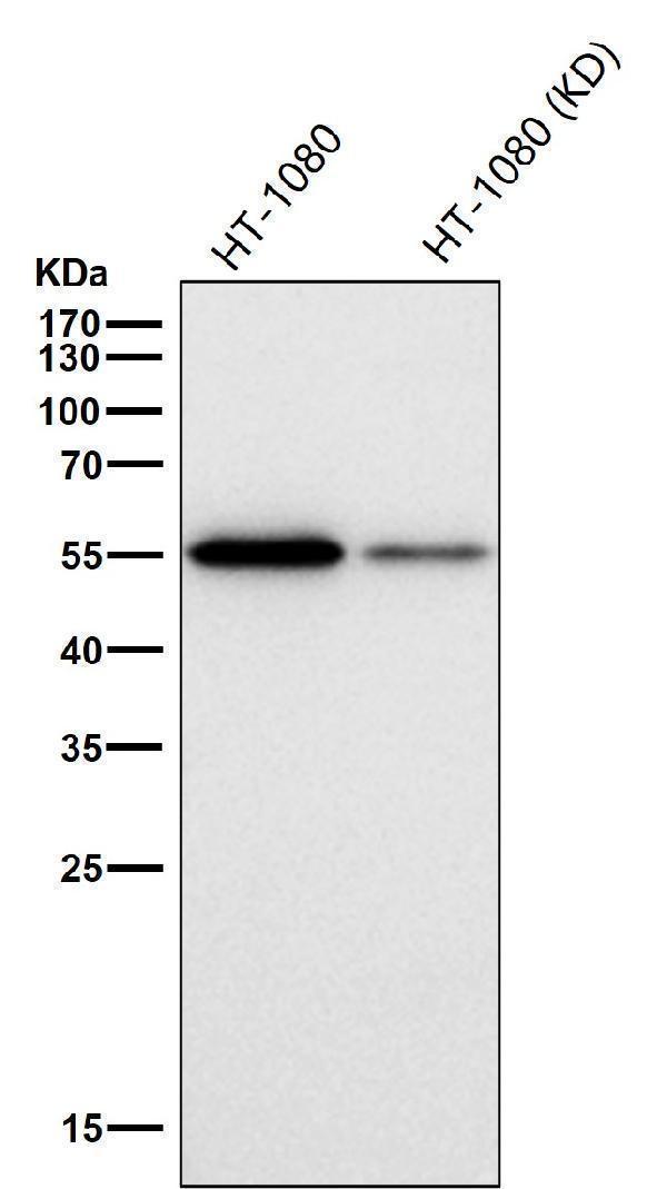 All lanes use the Antibody at 1:1k dilution for 1 hour at room temperature