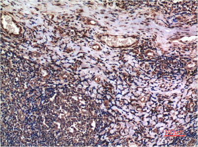 Immunohistochemical analysis of paraffin-embedded Human Tonsil Tissue using Cyclin B1 Mouse mAb diluted at 1:200