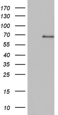 m00752 anti acid sphingomyelinase smpd1 mouse monoclonal antibody clone id oti3h7 wb testing 1
