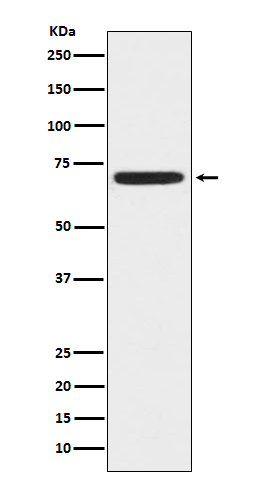 Western blot analysis of ZAP70 expression in Jurkat cell lysate