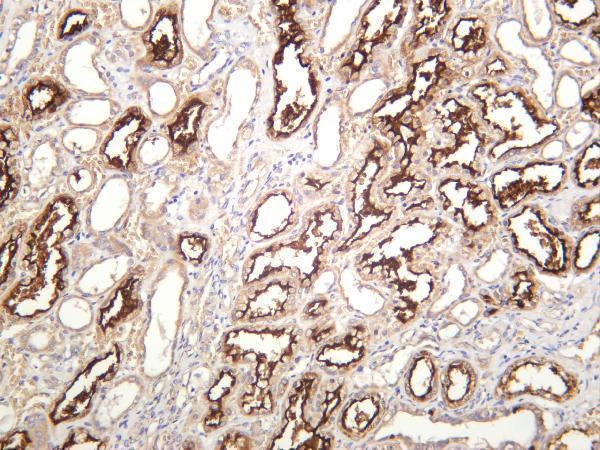 Human kidney was stained with anti-ACE2 rabbit antibody