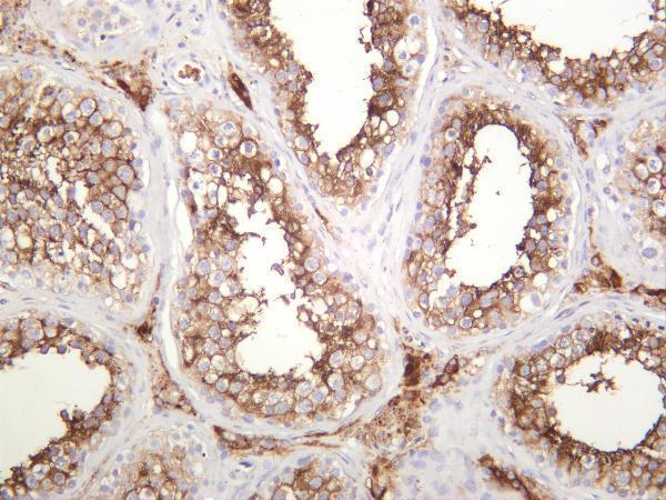 Human testis was stained with anti-ACE2 rabbit antibody
