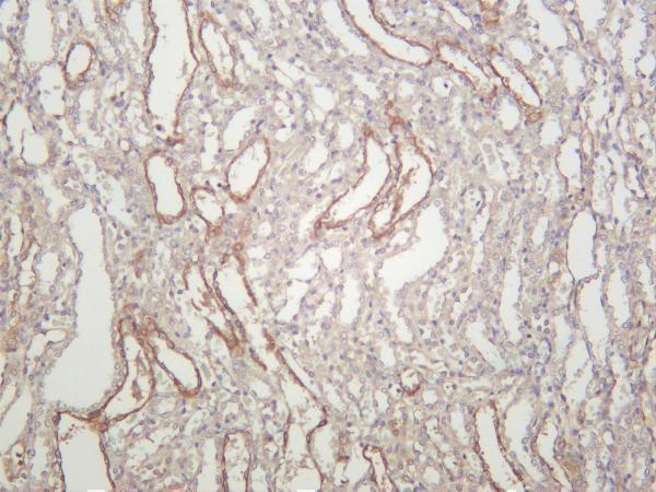 Rat kidney was stained with anti-ACE2 rabbit antibody