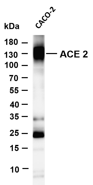 m00756 2 ace2 primary antibodies wb testing 1