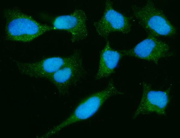 m00757 4 dj1 primary antibodies if testing 5