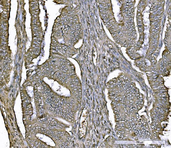  IHC analysis of PARK7/DJ1 using anti-PARK7/DJ1 antibody (M00757-4)