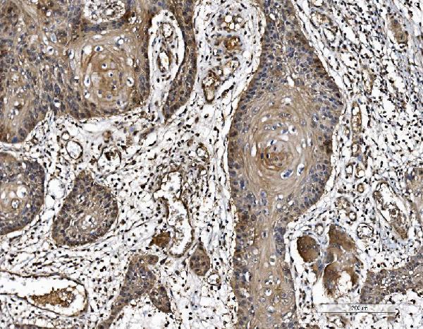  IHC analysis of PARK7/DJ1 using anti-PARK7/DJ1 antibody (M00757-4)