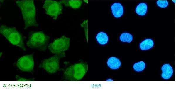 IF analysis of SOX10 using anti-SOX10 antibody (M00758-1) 