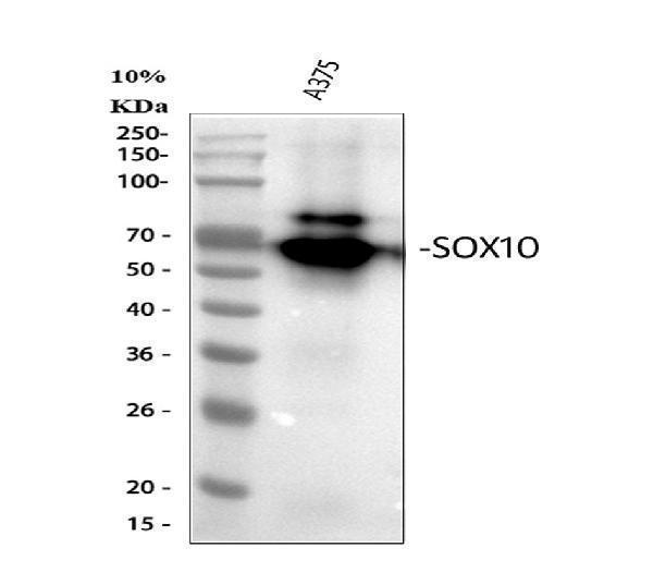 Western blot analysis of SOX10 using anti-SOX10 antibody (M00758-1)