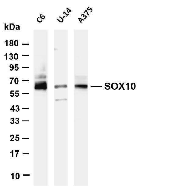 Various whole cell lysates were separated by 4-20% SDS-PAGE, and the membrane was blotted with anti-SOX10 antibody