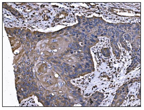 m00759 2 tgfbr2 primary antibodies ihc testing 4