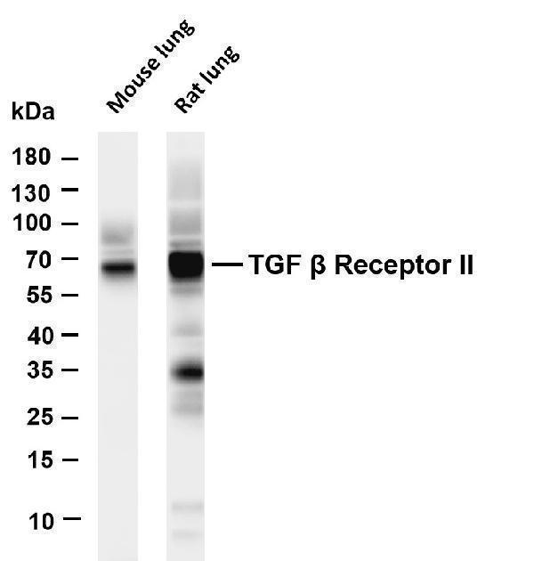 Various whole cell lysates were separated by 4-20% SDS-PAGE, and the membrane was blotted with anti-TGF β Receptor II antibody
