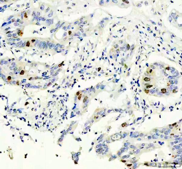 m00762 1 aurkb primary antibodies ihc testing 4