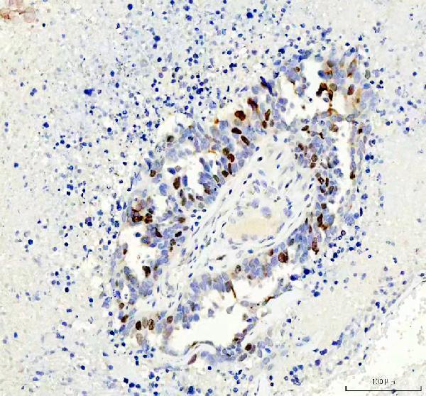 m00762 1 aurkb primary antibodies ihc testing 6
