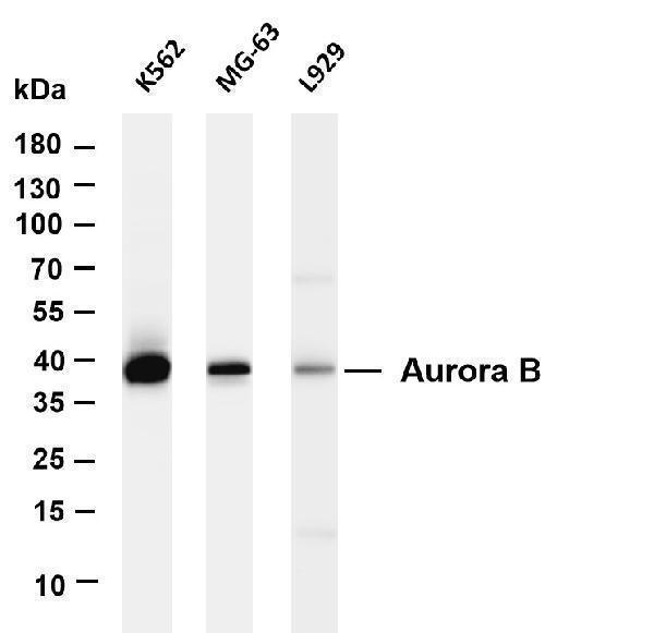 Various whole cell lysates were separated by 4-20% SDS-PAGE, and the membrane was blotted with anti-Aurora B antibody