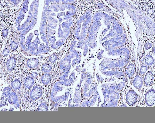  IHC analysis of Moesin/MSN using anti-Moesin/MSN antibody (M00766-2)
