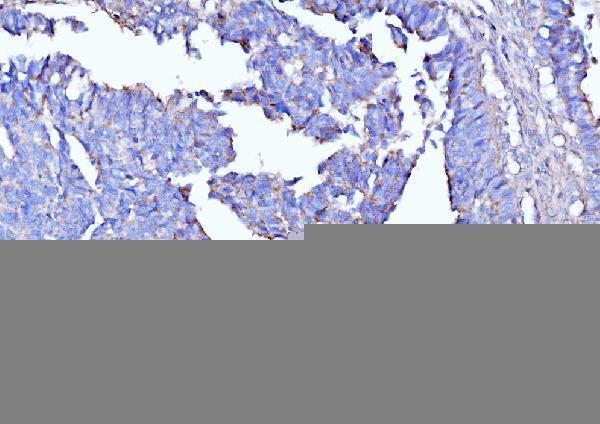  IHC analysis of Moesin/MSN using anti-Moesin/MSN antibody (M00766-2)