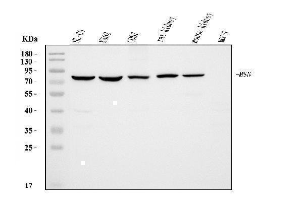  Western blot analysis of Moesin/MSN using anti-Moesin/MSN antibody (M00766-2)