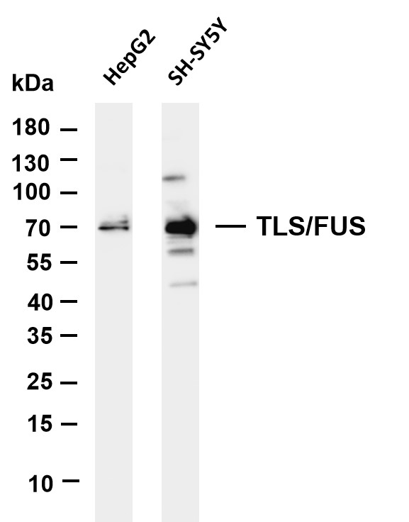 Various whole cell lysates were separated by 4-20% SDS-PAGE, and the membrane was blotted with anti-TLS/FUS antibody