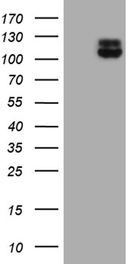HEK293T cells were transfected with the pCMV6-ENTRY control (Left lane) or pCMV6-ENTRY ITGB1 (Right lane) cDNA for 48 hrs and lysed
