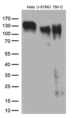 Western blot analysis of extracts (35ug) from 3 different cell lines by using anti-ITGB1 monoclonal antibody (1:500)