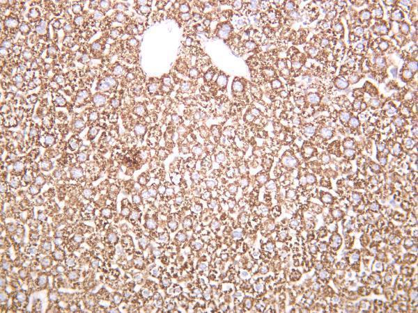 Mouse liver was stained with anti-MMP3 rabbit antibody