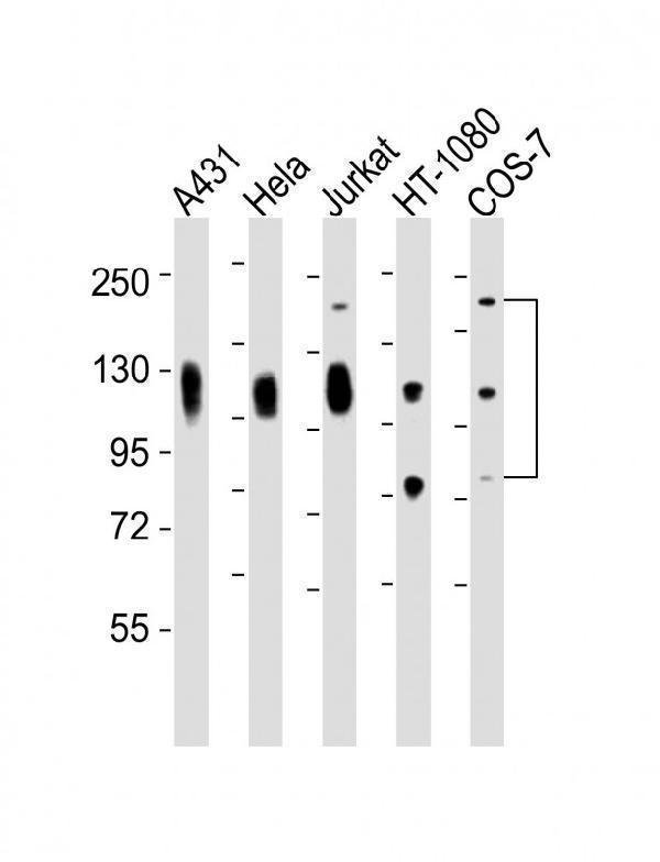 All lanes : Anti-LAMP1 Antibody at 1:2000 dilutionLane 1: A431 whole cell lysatesLane 2: Hela whole cell lysatesLane 3: Jurkat whole cell lysatesLane 4: HT-1080 whole cell lysatesLane 5: COS-7 whole cell lysatesLysates/proteins at 20 μg per lane