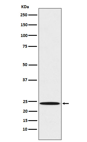 Western blot analysis of Mad2L1 expression in A431 cell lysate