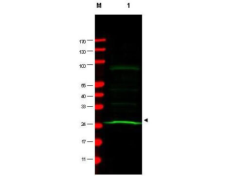 Western blot using Boster's Mab anti-MAD2L1 antibody shows detection of a band at ~24 kDa (arrowhead) corresponding to MAD2L1 present in a HeLa whole cell lysate 