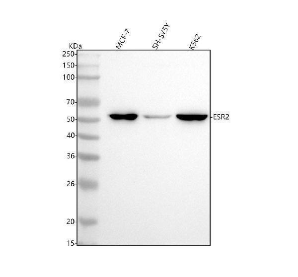 m00786 1 esr2 primary antibodies wb testing 1