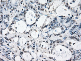 m00787 1 anti xrcc4 mouse monoclonal antibody clone id oti4h9 ihc testing 12