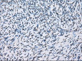 Immunohistochemical staining of paraffin-embedded Ovary tissue within the normal limits using anti-XRCC4mouse monoclonal antibody