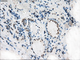 m00787 1 anti xrcc4 mouse monoclonal antibody clone id oti4h9 ihc testing 4