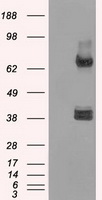 HEK293T cells were transfected with the pCMV6-ENTRY control (Left lane) or pCMV6-ENTRY XRCC4 (Right lane) cDNA for 48 hrs and lysed
