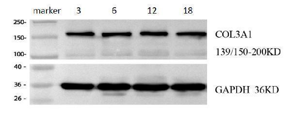 m00788 1 collagen3 primary antibodies wb review 1
